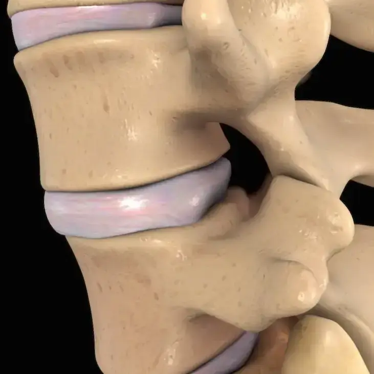Disc Injuries treatment at Jenks Clinic of Chiropractic