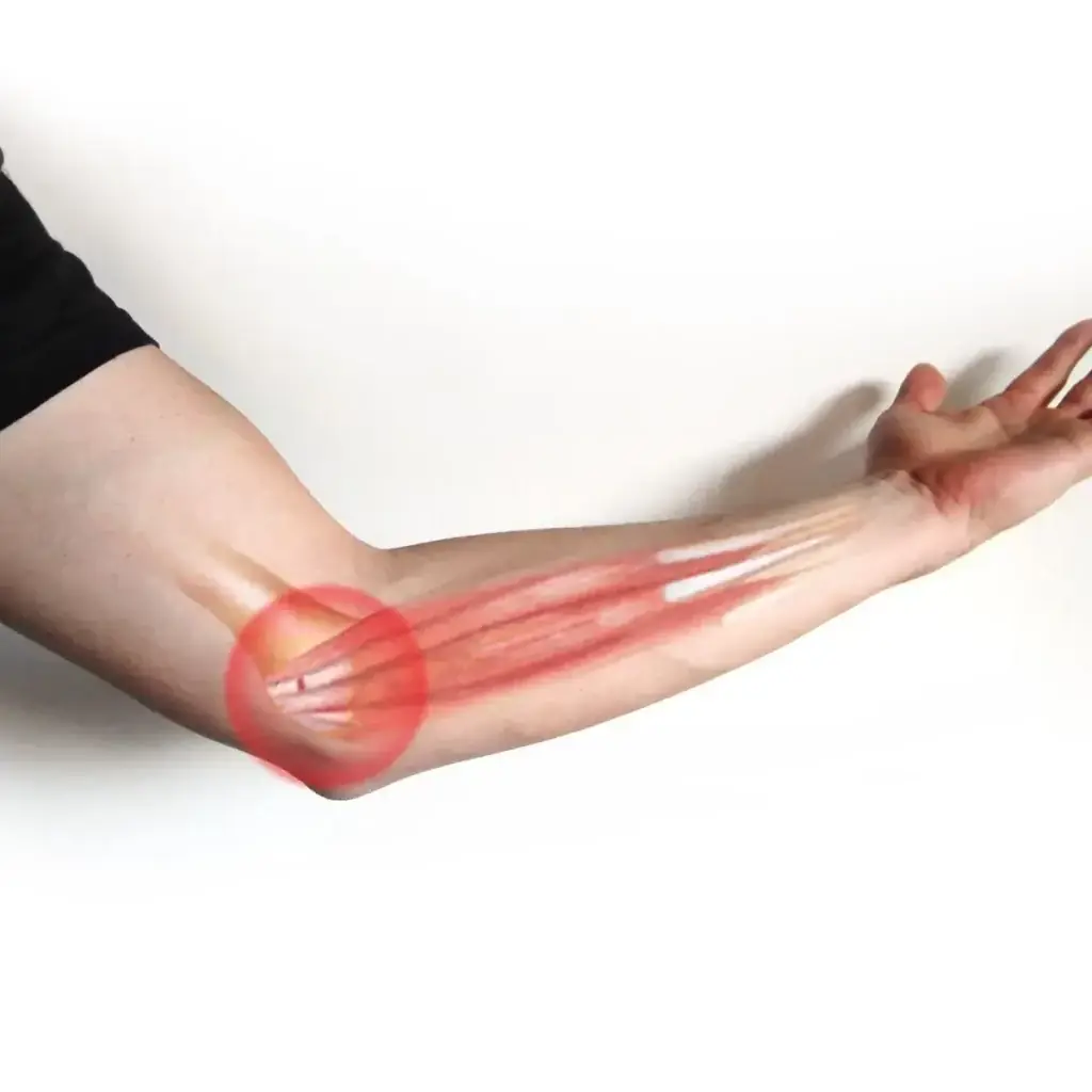 Golf or Tennis Elbow care at Jenks Clinic of Chiropractic